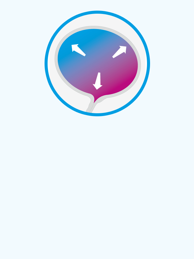 Use to extravasation incontinence